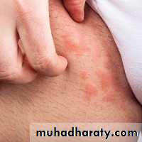 Dermatology sessions