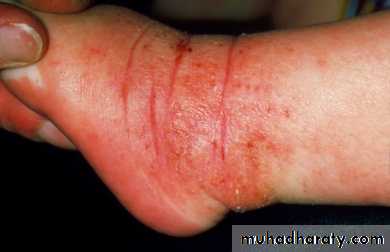 Dermatology sessions