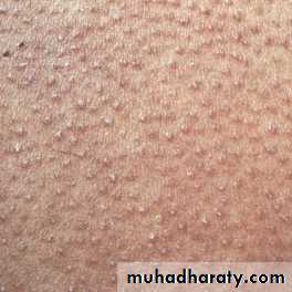 Dermatology sessions