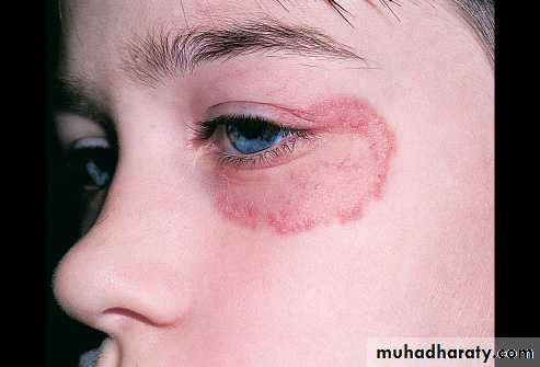 Dermatology sessions