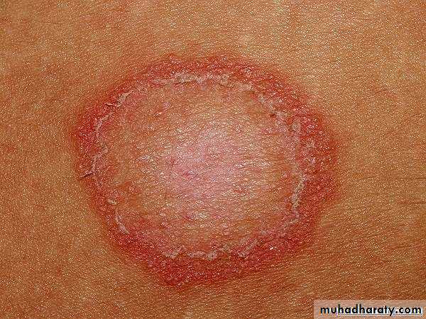 Dermatology sessions