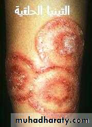 Dermatology sessions