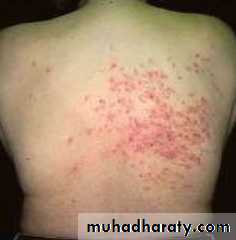 Dermatology sessions
