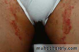Dermatology sessions