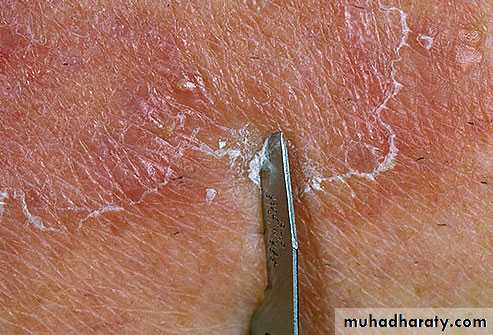 Dermatology sessions