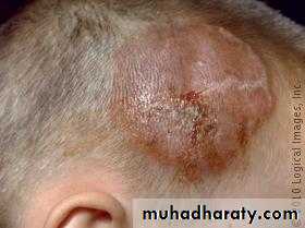Dermatology sessions