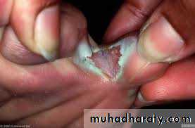 Dermatology sessions