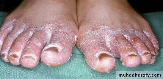 Dermatology sessions