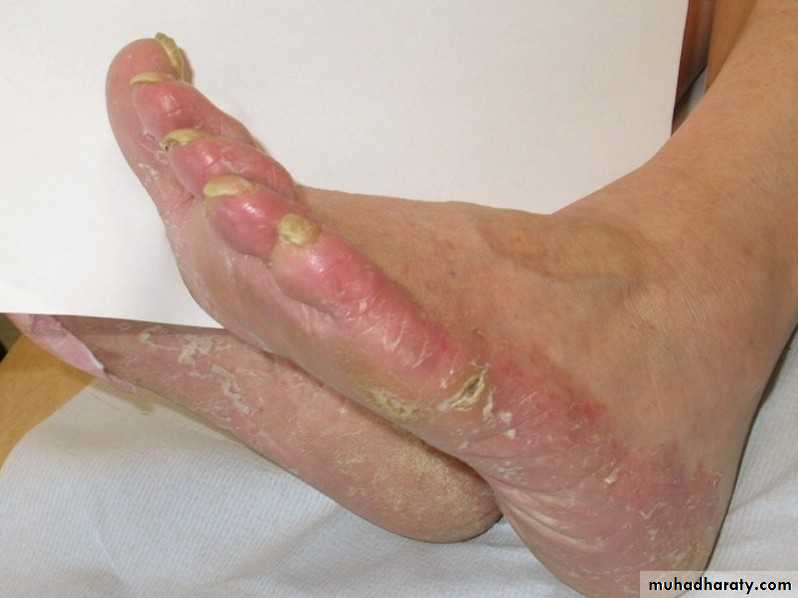 Dermatology sessions