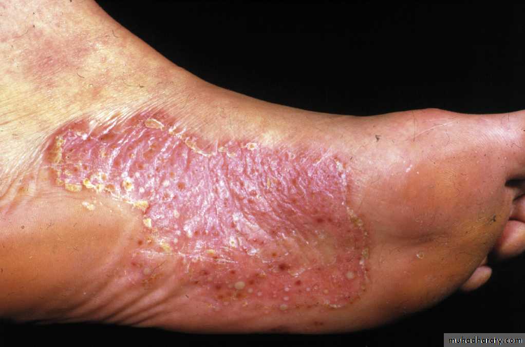 Dermatology sessions