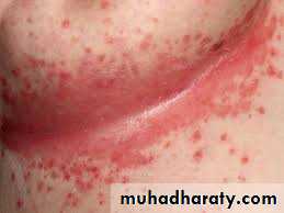 Dermatology sessions