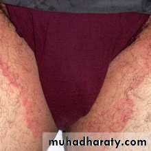 Dermatology sessions
