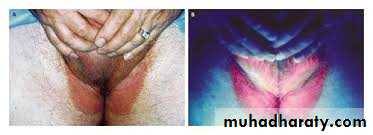 Dermatology sessions