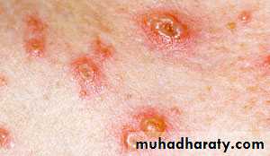 Dermatology sessions