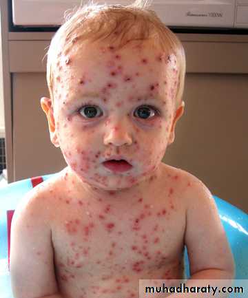 Dermatology sessions