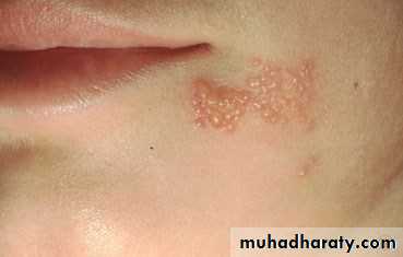 Dermatology sessions