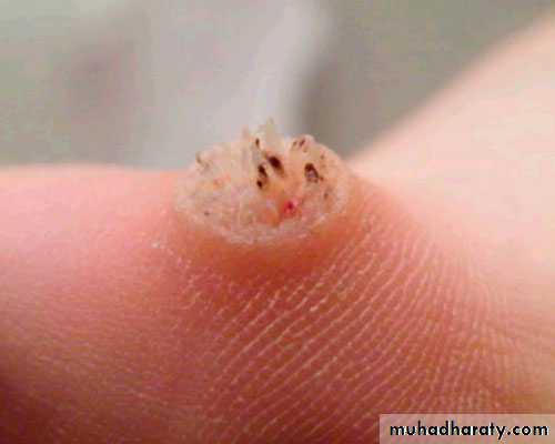 Dermatology sessions