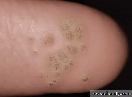 Dermatology sessions