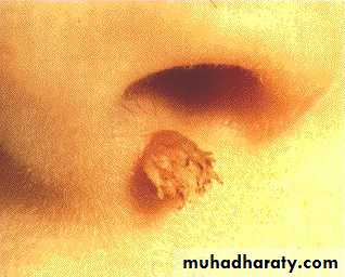 Dermatology sessions
