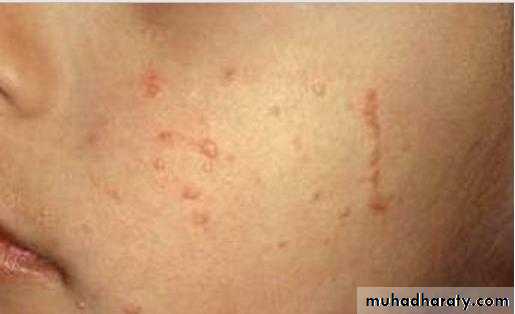 Dermatology sessions