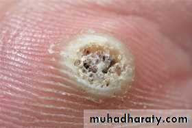 Dermatology sessions