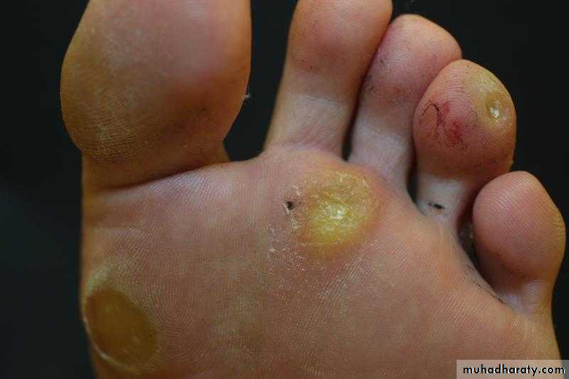Dermatology sessions