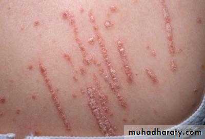 Dermatology sessions