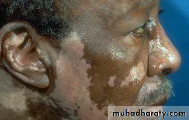 Dermatology sessions
