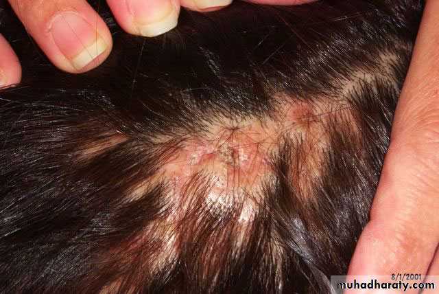 Dermatology sessions