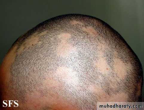 Dermatology sessions