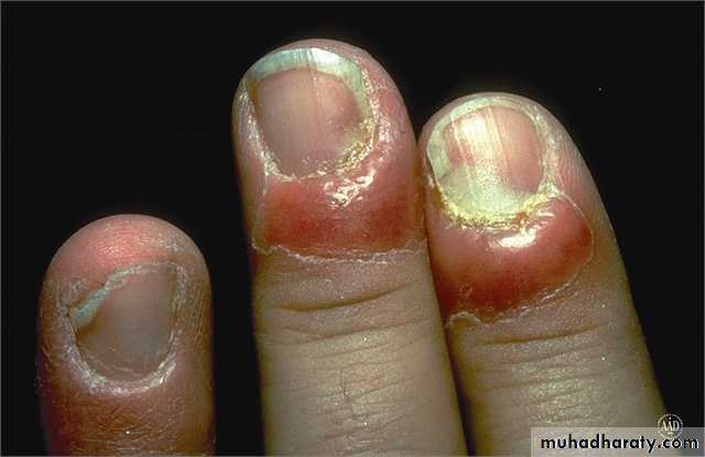 Dermatology sessions