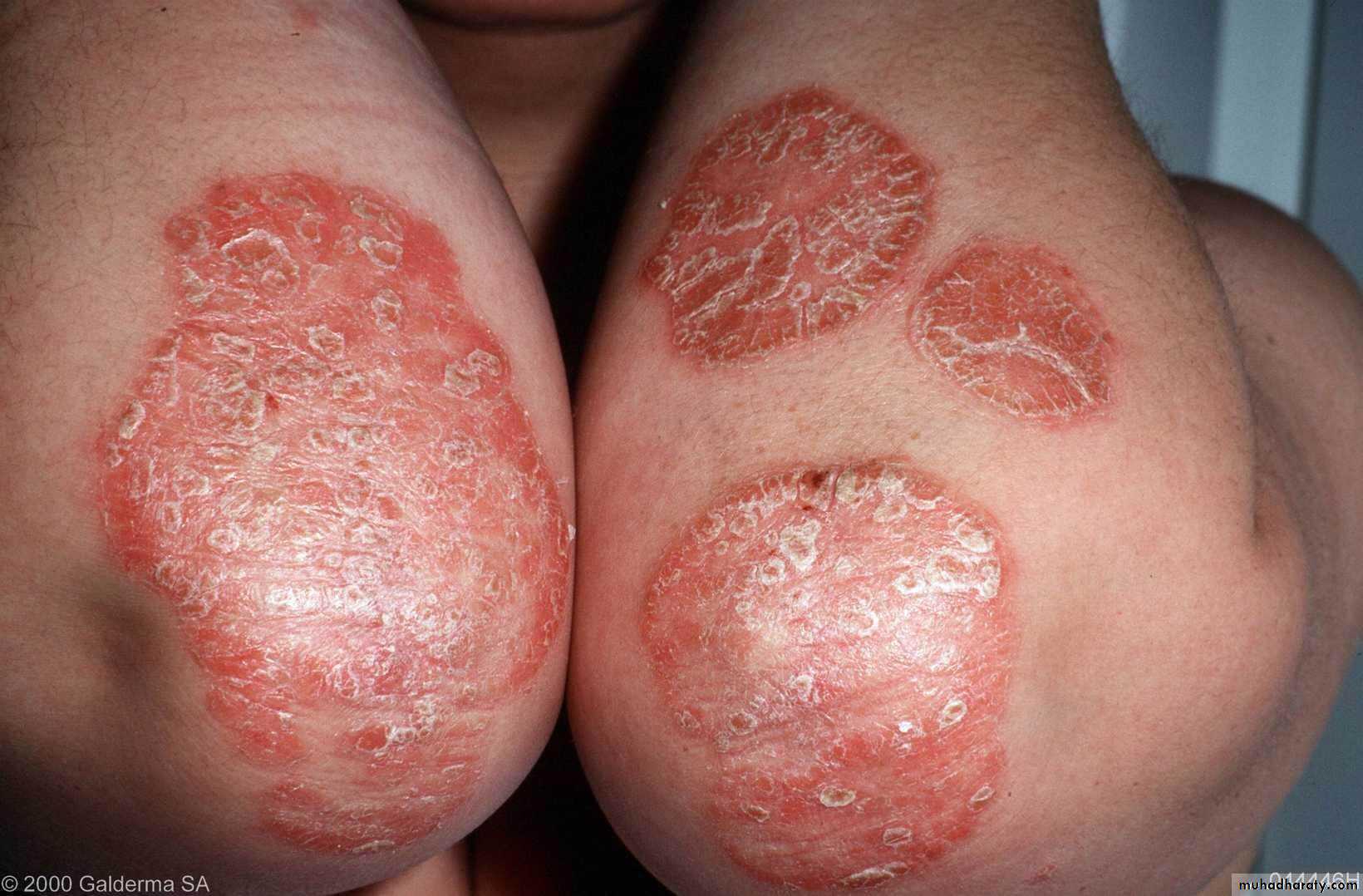 Dermatology sessions