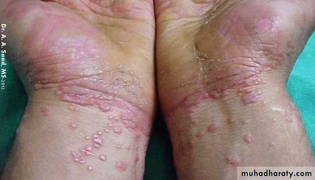Dermatology sessions