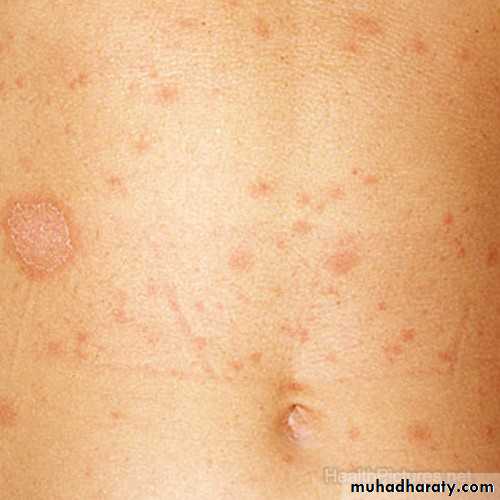 Dermatology sessions