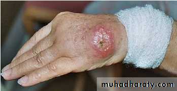 Dermatology sessions