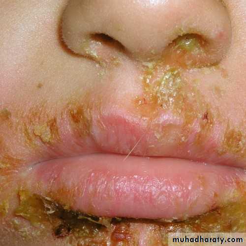 Dermatology sessions