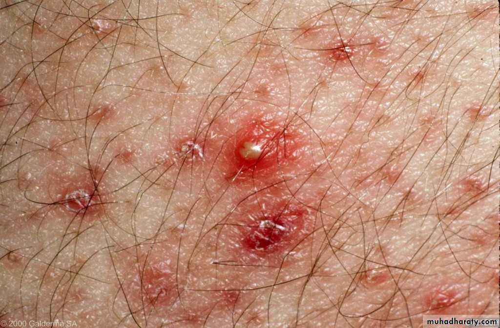 Dermatology sessions