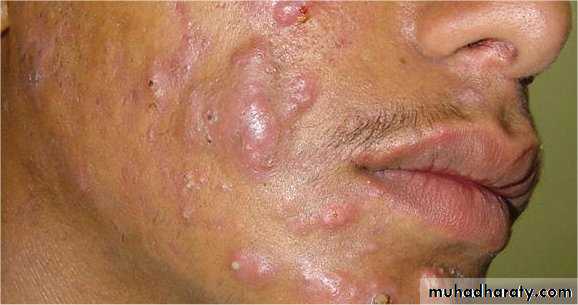 Dermatology sessions