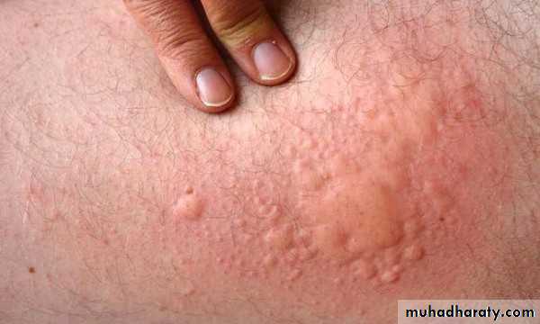 Dermatology sessions