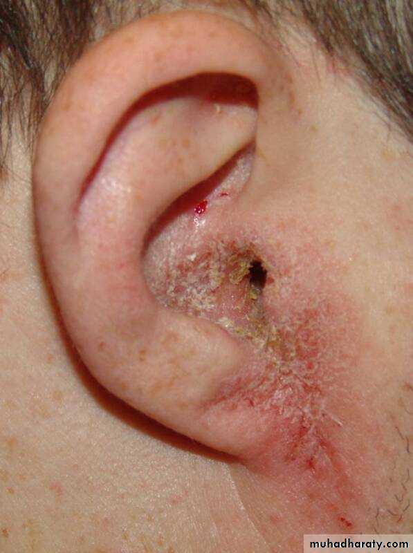 Dermatology sessions