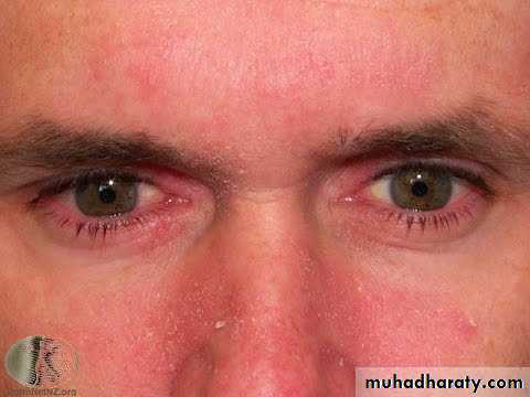 Dermatology sessions