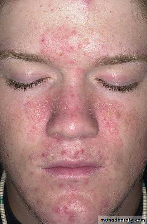 Dermatology sessions