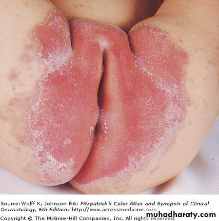 Dermatology sessions