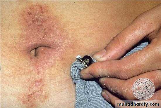 Dermatology sessions