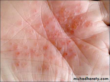 Dermatology sessions