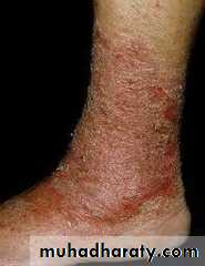 Dermatology sessions