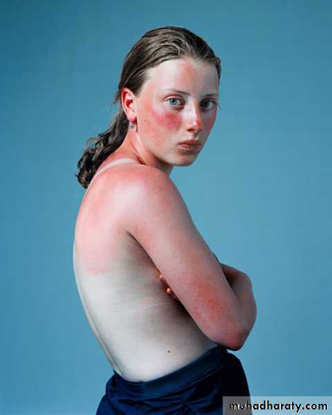 Dermatology sessions