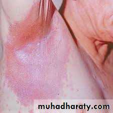 Dermatology sessions