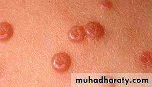 Dermatology sessions
