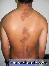 Dermatology sessions